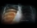 Expand Video